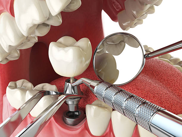 Best Emergency Dental Care for Sports Injuries in Circle Pines, MN
