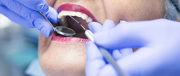 Best Knocked-Out Tooth (Avulsed Tooth) Treatment in Circle Pines, MN